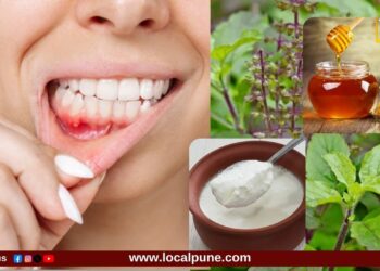 Health Update | सतत तोंड येण्याने त्रस्त आहात? मग करा घरगुती ‘हे’ गुणकारी उपाय