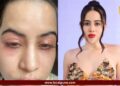 उर्फीच्या चेहऱ्याची झालीय ‘ही’ अवस्था; दर २ दिवसाला होते हालत, सोशल मीडियावर फोटो पोस्ट करत म्हणाली…